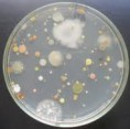 Morfología de las colonias bacterianas